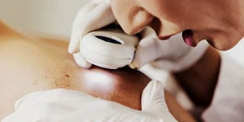 493ss_getty_rf_dermatologist_checking_skin